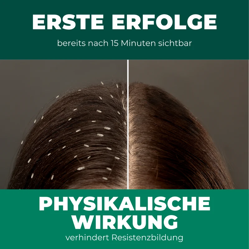 Kopfläuse-Shampoo - Läuseshampoo für Kinder & Erwachsene inkl. Nissenkamm Läuse Shampoo