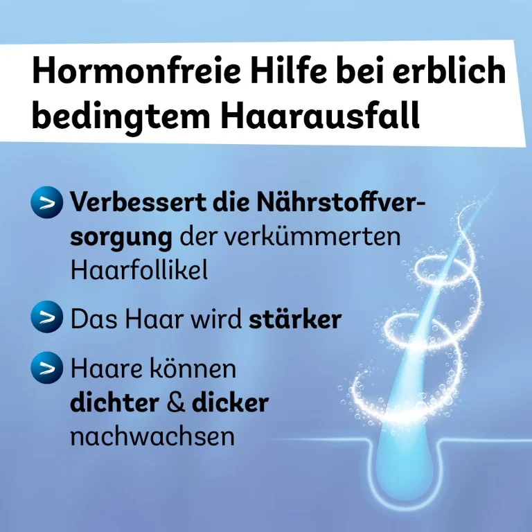 Minoxidil Dexcel 50 mg/ml Spray für Männer zur Anwendung auf der Haut (Kopfhaut), 60 ml Lösung