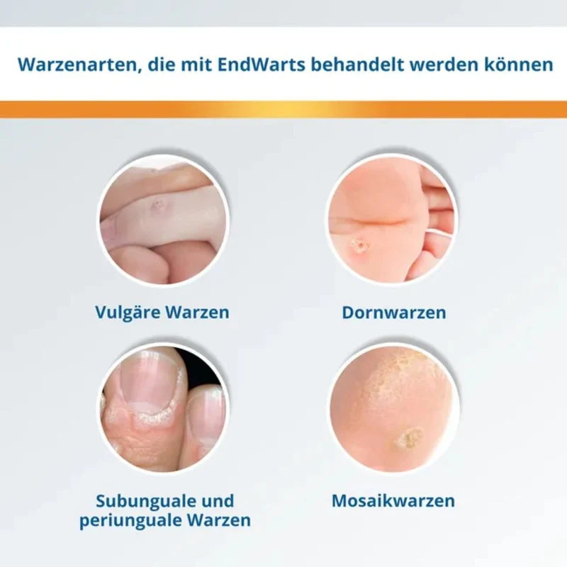 EndWarts PEN F Warzenbehandlung für Hände und Füße, 3 ml Lösung