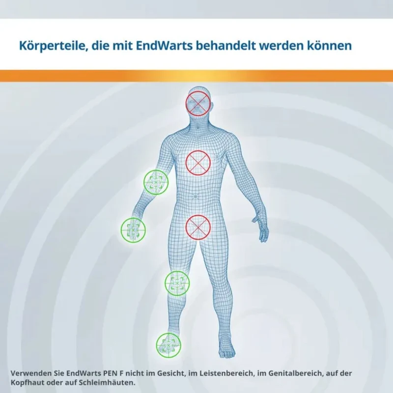 EndWarts PEN F Warzenbehandlung für Hände und Füße, 3 ml Lösung